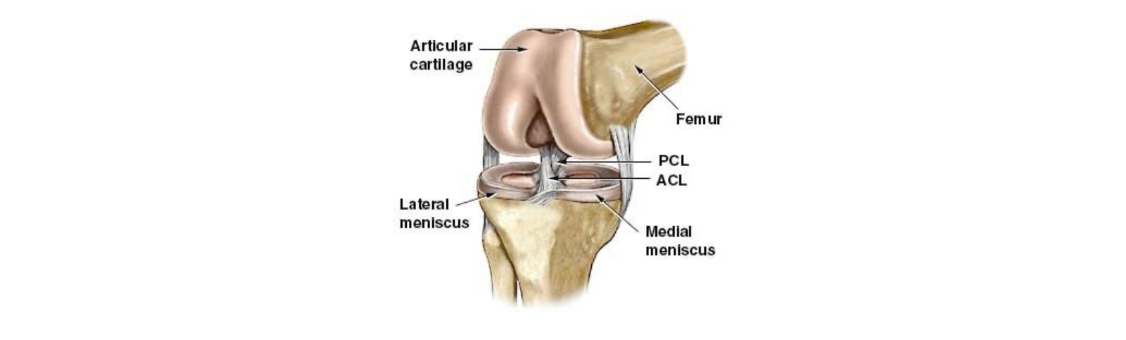 ACL image