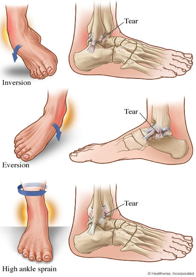 ankle-injuries